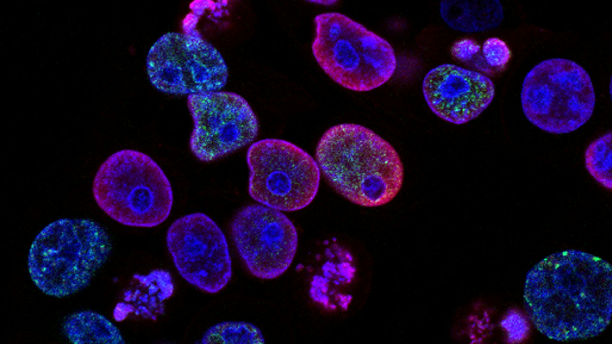 Microscope image of cells in blue and pink fluorescence